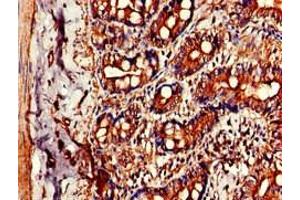 Immunohistochemistry of paraffin-embedded human small intestine tissue using ABIN7147277 at dilution of 1:100 (CIDEB 抗体  (AA 80-145))