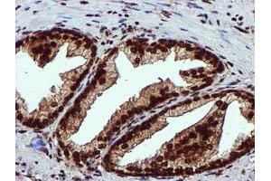 Image no. 3 for anti-EPM2A (Laforin) Interacting Protein 1 (EPM2AIP1) antibody (ABIN1498045) (EPM2AIP1 抗体)