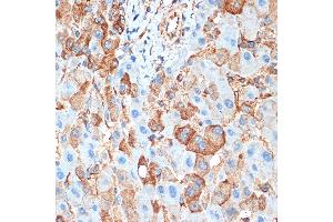 Immunohistochemistry (IHC) image for anti-Activin A Receptor, Type IB (ACVR1B) antibody (ABIN1678826)