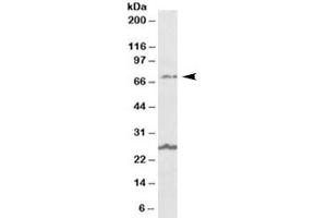 Western blot testing of human olfactory bulb lysate with SLC6A12 antibody at 1ug/ml. (SLC6A12 抗体)