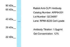 Western Blotting (WB) image for anti-Cleavage and Polyadenylation Factor I Subunit 1 (CLP1) (C-Term) antibody (ABIN2789763) (CLP1 抗体  (C-Term))