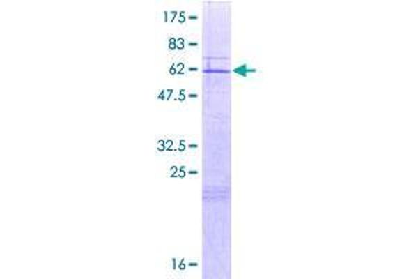CLYBL Protein (AA 1-340) (GST tag)