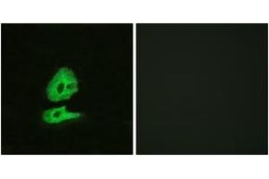 Immunofluorescence analysis of HeLa cells, using GLR Antibody. (GLRa2 抗体  (AA 95-144))