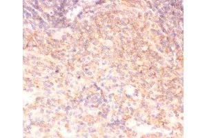 IHC-P: IKK alpha antibody testing of rat spleen tissue (IKK alpha 抗体  (AA 411-745))
