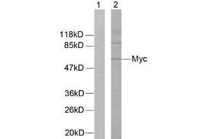 Western blot analysis of extracts from ovary cancer cells using Myc (Ab-58) antibody (E021034). (c-MYC 抗体)