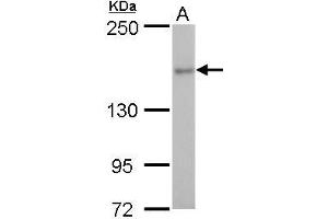 WB Image ROCK2 antibody detects ROCK2 protein by western blot analysis. (ROCK2 抗体)