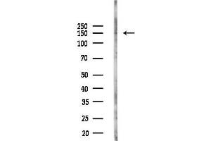 anti-Myosin Binding Protein C, Cardiac (MYBPC3) (C-Term) antibody