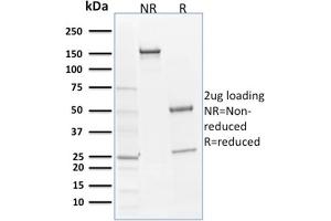 SDS-PAGE Analysis Purified SOX9 Mouse Monoclonal Antibody (SOX9/2398). (SOX9 抗体  (AA 393-508))