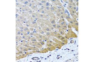 Immunohistochemistry of paraffin-embedded human liver using ARSF antibody at dilution of 1:100 (40x lens). (ARSF 抗体)