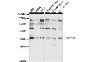 Western blot analysis of extracts of various cell lines, using DNTTIP1 antibody (ABIN7266731) at 1:1000 dilution. (DNTTIP1 抗体  (AA 1-329))