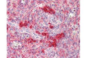 Anti-TSHZ2 antibody IHC staining of human spleen. (TSHZ2 抗体  (N-Term))