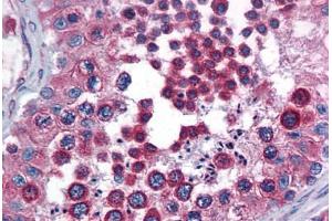 Human Testis: Formalin-Fixed, Paraffin-Embedded (FFPE) (Calnexin 抗体  (AA 204-218))