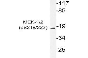 Western blot (WB) analyzes of p-MEK-1/2 antibody in extracts from 293 PMA cells. (MEK1 抗体  (pSer218, pSer222))