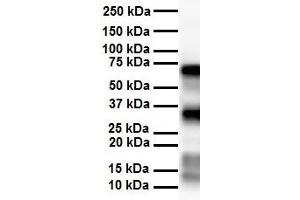 Western Blotting (WB) image for anti-Solute Carrier Family 25 (Mitochondrial Carrier, Aralar), Member 12 (Slc25a12) (Middle Region) antibody (ABIN2781595)
