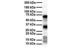 WB Suggested Anti-SLC25A12 antibody Titration: 1 ug/mL Sample Type: Human heart (SLC25A12 抗体  (Middle Region))