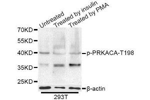 Western blot analysis of extracts of 293T cells,using Phospho-PRKACA-T197 antibody (ABIN5995920) at 1/1000 dilution. (PRKACA 抗体  (pThr198))