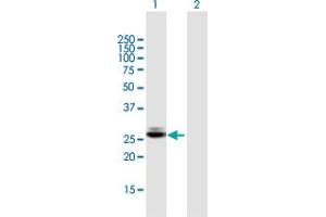 Western Blot analysis of CTRB1 expression in transfected 293T cell line by CTRB1 MaxPab polyclonal antibody. (CTRB1 抗体  (AA 1-263))