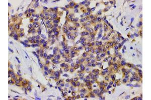 Immunohistochemistry (IHC) image for anti-Phosphoinositide 3 Kinase, p85 alpha (PI3K p85a) (pTyr607) antibody (ABIN6256775)