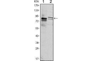 Western blot analysis using KLHL11 mouse mAb against Hela (1) and MCF-7 (2) cell lysate. (KLHL11 抗体)