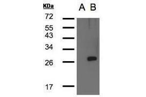 WB Image Western Blot analysis of LYPLA1 expression in transfected 293T cell line by LYPLA1polyclonal antibody. (LYPLA1 抗体)