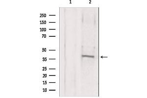 Western blot analysis of extracts from mouse brain, using MAT2B antibody.