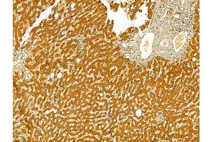 ABIN6265416 and ABIN6273079 at 1/100 staining Human normal tissues adjacent to liver cancer by IHC-P. (SYVN1 抗体  (Internal Region))