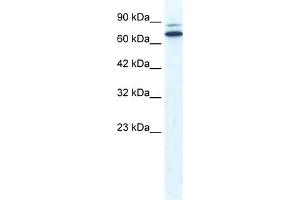 WB Suggested Anti-ZNF57 Antibody Titration:  0.