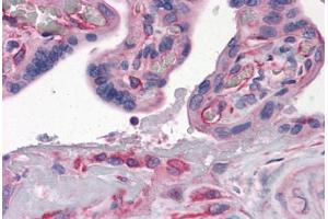 Human Placenta: Formalin-Fixed, Paraffin-Embedded (FFPE) (GBP1 抗体  (AA 1-593))
