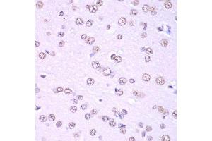 Immunohistochemistry (Paraffin-embedded Sections) (IHC (p)) image for anti-Non-POU Domain Containing, Octamer-Binding (NONO) (AA 1-300) antibody (ABIN6144713)