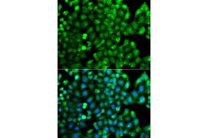 Immunofluorescence analysis of A549 cell using HLA-DRB1 antibody. (HLA-DRB1 抗体)