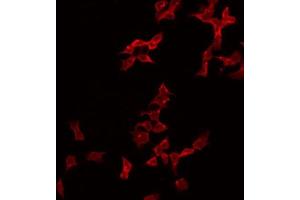 ABIN6274995 staining Hela by IF/ICC. (CBLN2 抗体  (N-Term))