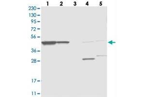 Western blot analysis of Lane 1: RT-4, Lane 2: U-251 MG, Lane 3: Human Plasma, Lane 4: Liver, Lane 5: Tonsil with OLA1 polyclonal antibody  at 1:250-1:500 dilution. (OLA1 抗体)