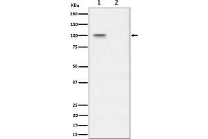 Western blot analysis of Phospho-Nucleolin (T76) expression in (1) 293T cell lysate, (2) 293T cell treated with Lambda Phosphatase lysate.
