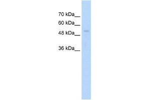 WB Suggested Anti-ARIH1 Antibody Titration:  1. (ARIH1 抗体  (C-Term))