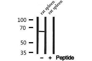 Western Blotting (WB) image for anti-Solute Carrier Family 6 (Neurotransmitter Transporter, GABA), Member 13 (SLC6A13) (Internal Region) antibody (ABIN6265142)