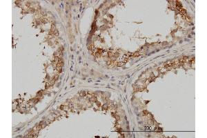 Immunoperoxidase of monoclonal antibody to PSMB4 on formalin-fixed paraffin-embedded human testis.