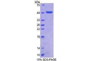 SDS-PAGE analysis of Human SUMO2 Protein. (SUMO2 蛋白)