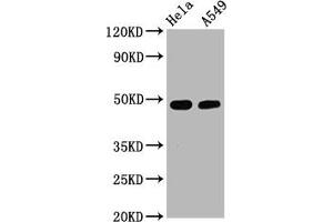 Western Blot Positive WB detected in Hela whole cell lysate,A549 whole cell lysate All lanes Phospho-GATA3 antibody at 2. (Recombinant GATA3 抗体  (pSer308))