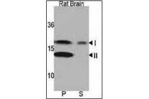 Western blot analysis of LC3 Antibody in Rat brain lysate. (MAP1LC3A 抗体  (N-Term))