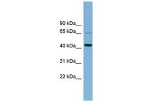 Image no. 1 for anti-UEV and Lactate/malate Dehyrogenase Domains (UEVLD) (AA 143-192) antibody (ABIN6742158) (UEVLD 抗体  (AA 143-192))