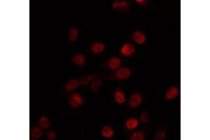 ABIN6266731 staining Hela by IF/ICC. (MBD3 抗体  (C-Term))