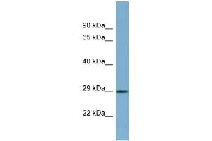 WB Suggested Anti-PRR16 Antibody Titration: 0. (PRR16 抗体  (Middle Region))