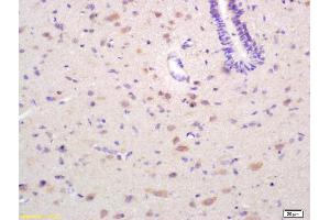 Formalin-fixed and paraffin embedded rat brain labeled with Rabbit Anti EPH receptor A4 Polyclonal Antibody, Unconjugated (ABIN734123) at 1:200 followed by conjugation to the secondary antibody and DAB staining (EPH Receptor A4 抗体  (AA 531-630))