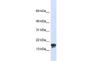 WB Suggested Anti-TMEM166 Antibody Titration:  0. (TMEM166 抗体  (N-Term))