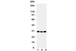 Western blot testing of CD134 antibody and mouse samples 1:  brain;  2: spleen;  3: liver tissue lysate. (TNFRSF4 抗体  (N-Term))