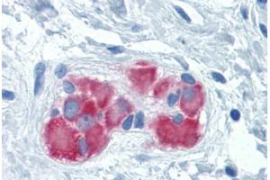 Human Colon, submucosal plexus: Formalin-Fixed, Paraffin-Embedded (FFPE) (FARSB 抗体  (AA 234-342))
