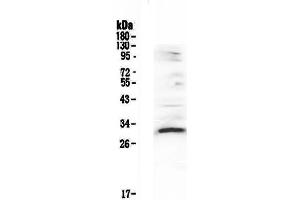 Western blot analysis of VEGFB using anti-VEGFB antibody . (VEGFB 抗体  (AA 22-207))