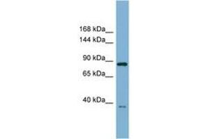 ESYT3 Antikörper  (AA 359-408)