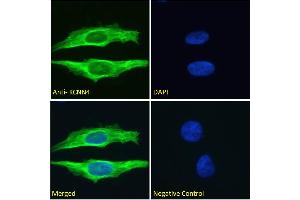 ABIN6391378 Immunofluorescence analysis of paraformaldehyde fixed HeLa cells, permeabilized with 0. (KCNN4 抗体  (Internal Region))