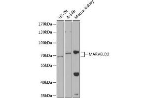 Western blot analysis of extracts of various cell lines, using M antibody  at 1:1000 dilution. (Tricellulin 抗体  (AA 1-195))